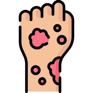 What Does Proactive Do For Rosacea