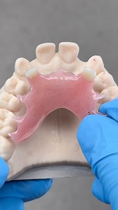 Upper Valplast Partial! Case from Dr. Umair Waheed in Michigan! @_etec_ | CEO Luke Kahng