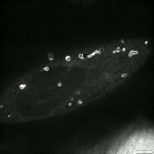 Never miss a live‑cell event with Evident's award-winning IXplore™ IX85 SpinSR super‑resolution microscope. Designed for extended cell viability during time‑lapse experiments, the IX85 SpinSR captures ultra‑small cellular dynamics in stunning detail. With imaging at speeds up to 200 fps at full frame, the IX85 SpinSR captures every specimen with extreme clarity, ensuring your findings are as accurate as can be. Request a personalized demo today: https://ow.ly/uPNg50XucWC #LiveCellImaging #Imagin