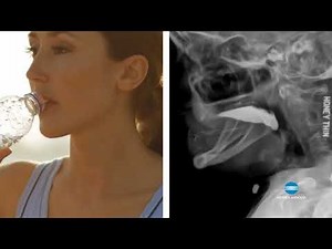 Visualize Swallowing Dynamics with Dynamic Digital Radiography (DDR) | Konica Minolta Healthcare
