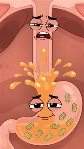 What Happens To Your Esophagus When You Overeat? #medicalanimation #health #shorts