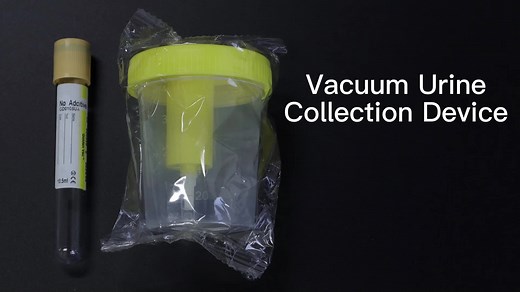 Medical Use Specimen Container 120ml Graduated Urine Collection Cup Disposable Container with Needle / Vacuum Urine Tube Kit