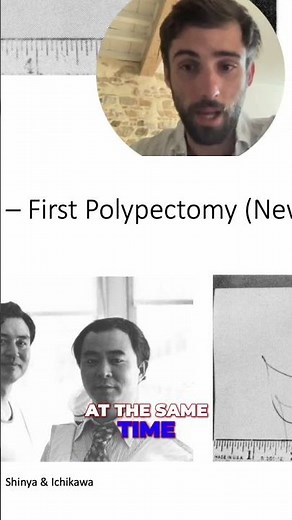 Japanese Doctors Revolutionized Endoscopy: The First Polypectomy! #shorts