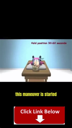Inserir um subtíhe Deep Head-Hanging maneuver is performed to treat BPPV of the SUPERIOR or ANTERIOR canal. Animation showing what is happening inside the inner ear is also shown in the second half of the video. The Epley maneuver is used to treat BPPV of the POSTERIOR canal shown here #Vertigenics, What is Vertigenics, #vertigenicsreviews #benefits, #Vertigenicsreview, #Vertigenicshow o use, Vertigenics where to buy, #Vertigenicsresult # #Vertigenicssafety, does #Vertigenicswork, best #suppleme