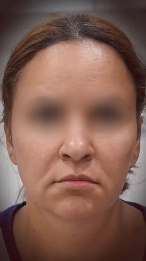 2K views · 72 reactions |  ¿Mini Face Lift? El cambio parece sutil…...