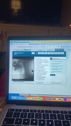 If you’re an SLP you know…. #mbsimp #simucase#swallowstudy #slpgradstudent #dysphagia #dysarthria #sos