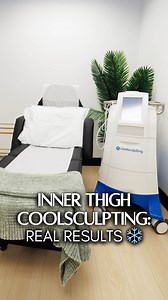 Targeted. Precise. Noticeable. ❄️ This CoolSculpting transformation highlights the inner thighs — one of the most requested areas for sculpting and reshaping. A non-invasive approach to fat reduction that supports visible change without surgery or downtime. 📌 Complimentary consultations available for personalized body contouring plans. ✨ Free personal assessment always included. ___ coolsculpting inner thighs, inner thigh fat reduction, inner thigh sculpting Toronto, non-surgical fat reduction 