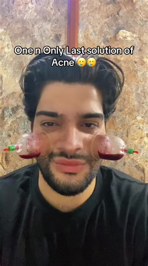 Effective Acne Treatment Tips for Ramadan