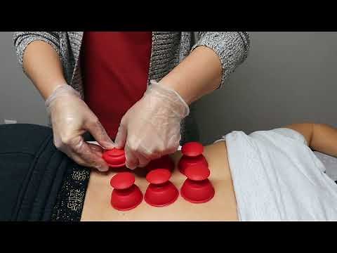 Cupping Therapy