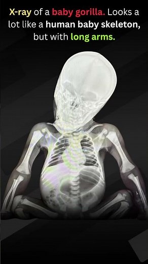 Baby Gorilla Skeleton vs Human Infant Skeleton | 98% Shared DNA Explained