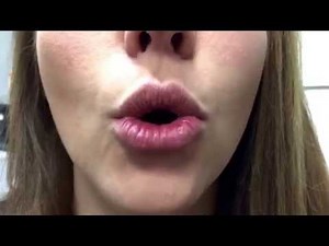 Oral motor exercise 1