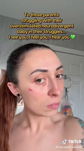 Supporting Overstimulated Neurodivergent Kids