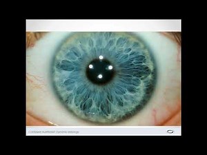 Iridology: Intestinal Markers Introduction (Collarette)