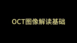 眼视光专业技术知识（四十六）：《OCT图像解读基础》