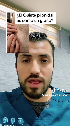 Quiste Pilonidal: Causas y Soluciones.