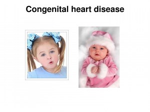 Congenital heart disease - SlideServe
