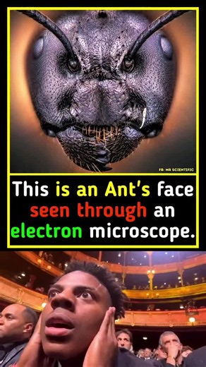 Ant's face 😱😰 in Microscope 🔬 | ant