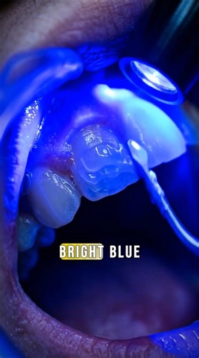 Chipped Tooth? This Fixes It Instantly 😨