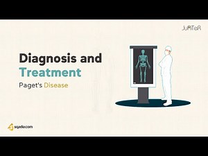 Pagets Disease | Diagnosis and Treatment