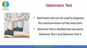 Steinman Test • What For • Easy Explained | OrthoFixar 2026