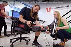 "Bionic" Leg Powered by AI - Mechanical Engineering | University of Utah