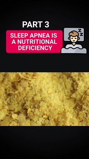 Sleep Apnea Is a Nutritional Deficiency Part 3 #sleepapnea #sleep #diabetic #snoring #apnea #vitaminb1 #sleep #fyp #beriberi #sids #nutritionalyeast