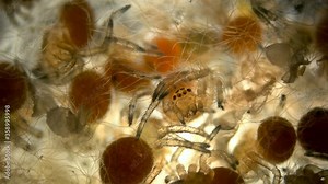 Spider under a microscope, Arachnida class, Arthropoda squad, in the video a cocoon from a web in which young spiders move, Spiders are predators, feed primarily on insects or other small animals Stock Video