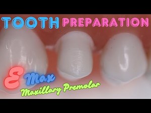Tooth Preparation for Emax Crown on Maxillary First Premolar 🟡 Step By Step