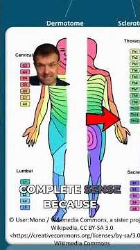 Why Are Dermatome Maps Twisted? The Embryo's Secret