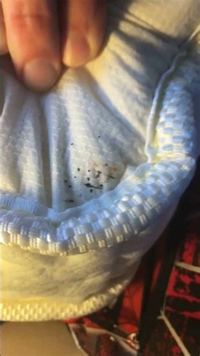 The Second Bed Bug Spot I Almost Missed 😳