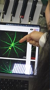 Researchers find new link between brain and eye health