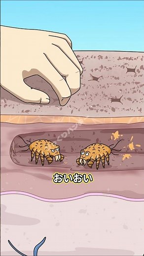 夜の太もも激かゆみの本当の原因