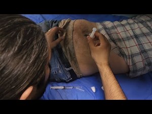 Ultimate IM Injection Compilation in the ER! Real Procedures & Nursing Skills ( 53)