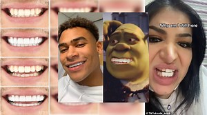 Turkey Teeth | Know Your Meme