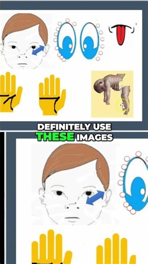 Understand 5 Critical Medical Complications: A Guide #shorts