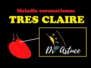 Coronary Artery Disease (Heart Attack) Explained VERY CLEARLY - Dr. Astuce