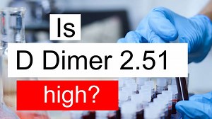 Treatment and symptoms of D Dimer 2.51 ug/mL | Diet for high D Dimer level 2.51 ug/mL