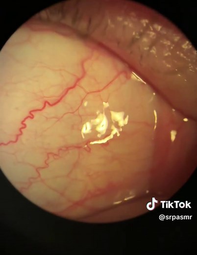 Inside the Eye Exam: Optometrist POV with Slit Lamp