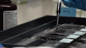 Author Spotlight: Neutrophil Extracellular Traps Imaging in Human and Mouse Tissues