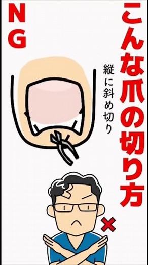 足の爪の正しい切り方