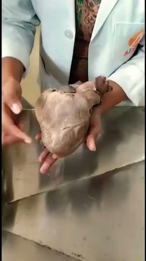 Real Human Heart | Explained by MBBS Students