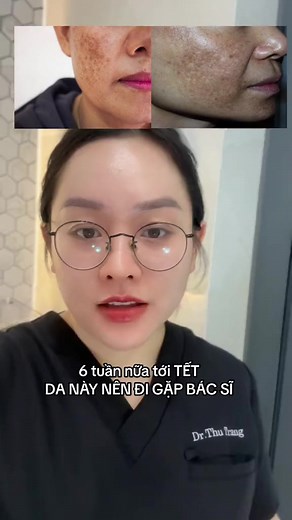 1.5K views · 12 reactions | Tết tới nơi rồi ôi dồi ôi làm đẹp ngay đi thôi, chần chừ là ko có kịp nhen mấy bà ơi Tham gia nhóm với mình dưới comment nhé. | Bác sĩ Trang Da Liễu | Facebook