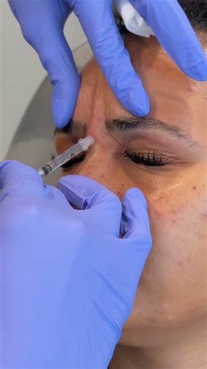 Botox and Dermal Filler Injections with Julie Holesh, PA | Claytor Plastic Surgery