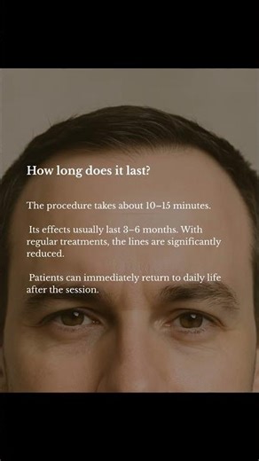 ✨ Botox for Forehead & Frown Lines ✨