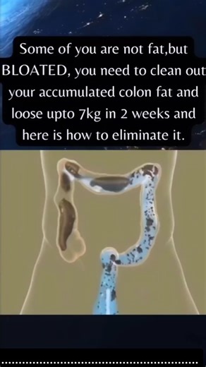 268 reactions · 4 comments | Natural Colon Flush Regular intake will...