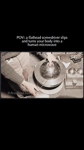 On May 21, 1946, physicist Louis Slotin was performing a high stakes experiment known as “tickling the dragons tail” at the Los Alamos National Laboratory in New Mexico. Slotin was using a 6.2 kilogram plutonium core, later known as the Demon Core, to establish the exact point of criticality. He was manually lowering a beryllium tamper over the core using only the blade of a flathead screwdriver to maintain a tiny gap that allowed neutrons to escape. The horror began when the screwdriver slipped