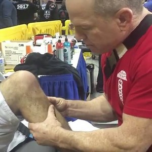 361K views · 1.8K shares | Incredible footage from @dr.kreiswirth showing the tibial sag due to PCL rupture. Look how easily the tibia translates posteriorly ⠀ ➖➖➖➖➖➖➖➖➖➖➖➖➖➖➖➖⠀ #Physiotutors #pcl | Physiotutors | Facebook