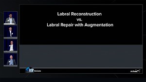 Panel Debate: Labral Reconstruction vs Repair With Augmentation
