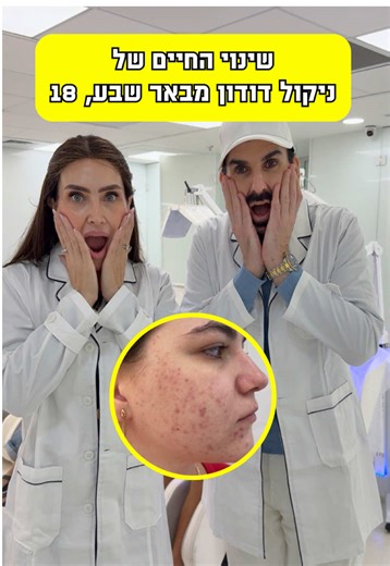 רואקוטן? ניקול דודון, בת 18 מבאר שבע, הגיעה אל רבקה זיידה עם הרבה תקווה, אבל גם אחרי הרבה אכזבה. אחרי חודשים ארוכים של נטילת התרופה רואקוטן ואז כל האקנה חזר ובגדול😥 אצלנו ניקול מצאה משהו אחר. שיטה טבעית, עדינה, ללא מגע כלל בעור, ללא כאב, בלי לחיצות בפנים וללא ניקוזים! שיטה מהפכנית שלא נלחמת בעור, אלא מבינה מה הוא צריך באמת ועובדת כמו קסם כבר 25 שנים🤩 והיום? ניקול רואה בעיניים שלה את השינוי המטורף שעבר העור 😍 ובשבילנו- זו זכות אמיתית 🙏🏻 #טיפולבאקנה #אקנהצלקות #רואקוטן #אקנהבפנים #רבקהזיידה #