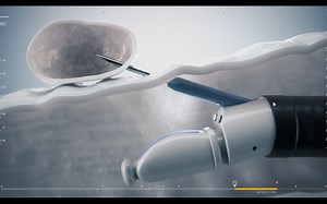 介入性支气管镜医生的支气管内超声（EBUS）指南